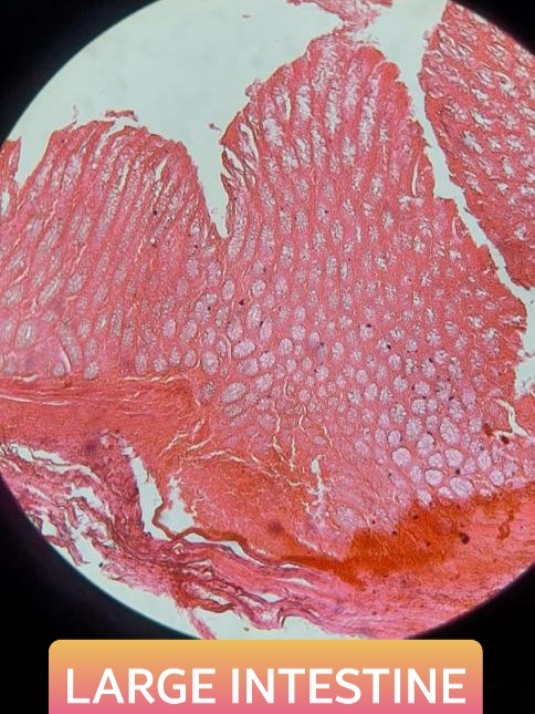large intestine histology slide for mbbs 1st year