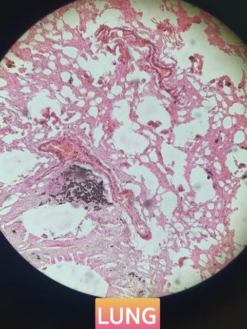 lung histology slide for mbbs 1st year