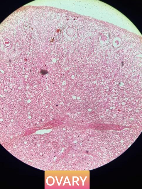 ovary histology slide for mbbs 1st year