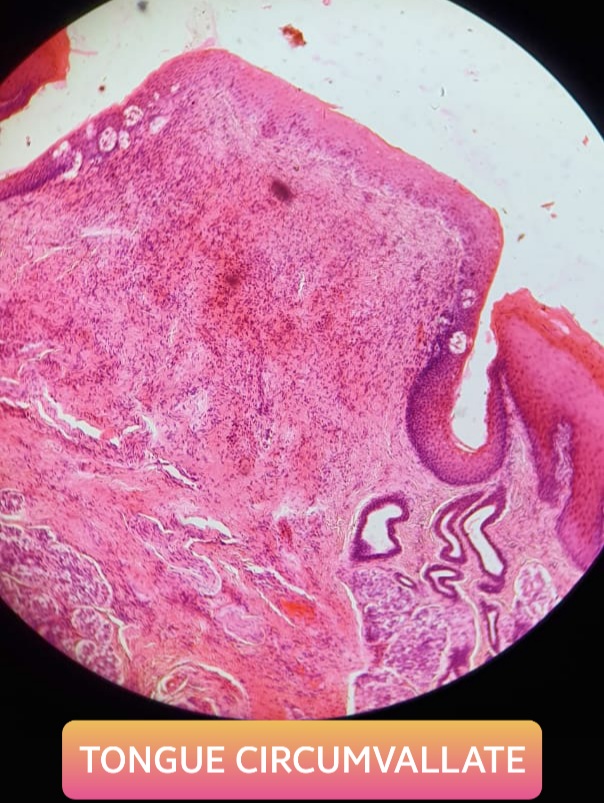 tongue circumvallate papillae histology slide for mbbs 1st year